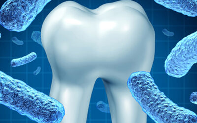 Parodontite e malattie sistemiche: quale correlazione?